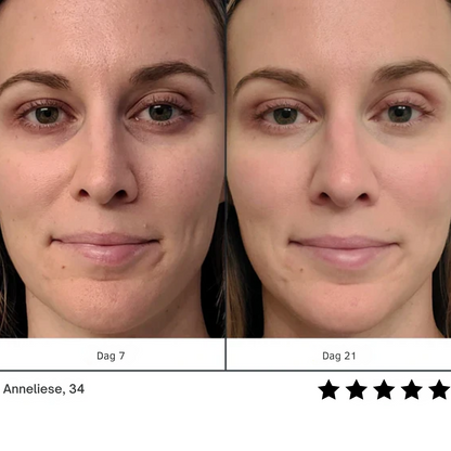 Virela™ | Vermindert donkere kringen en wallen