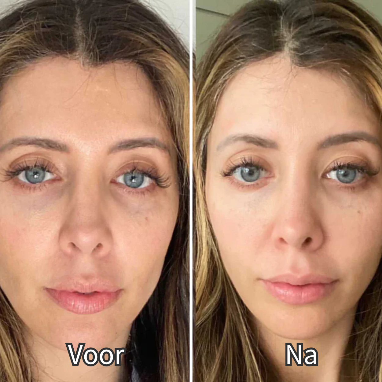 Odeline Pro™ Oog Therapie - Slechts 3 minuten per sessie