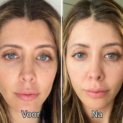 Odeline Pro™ Oog Therapie - Slechts 3 minuten per sessie