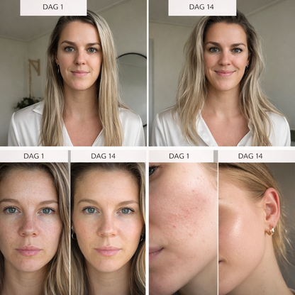 Virela™ | Vermindert donkere kringen en wallen