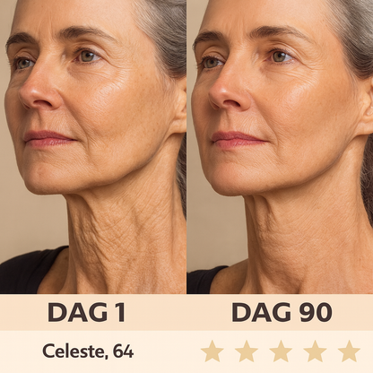 LumiLift™ – Voor een Strakkere, Stralende Huid