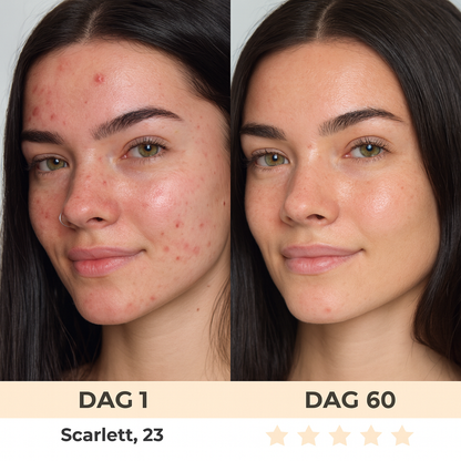 LumiLift™ – Voor een Strakkere, Stralende Huid